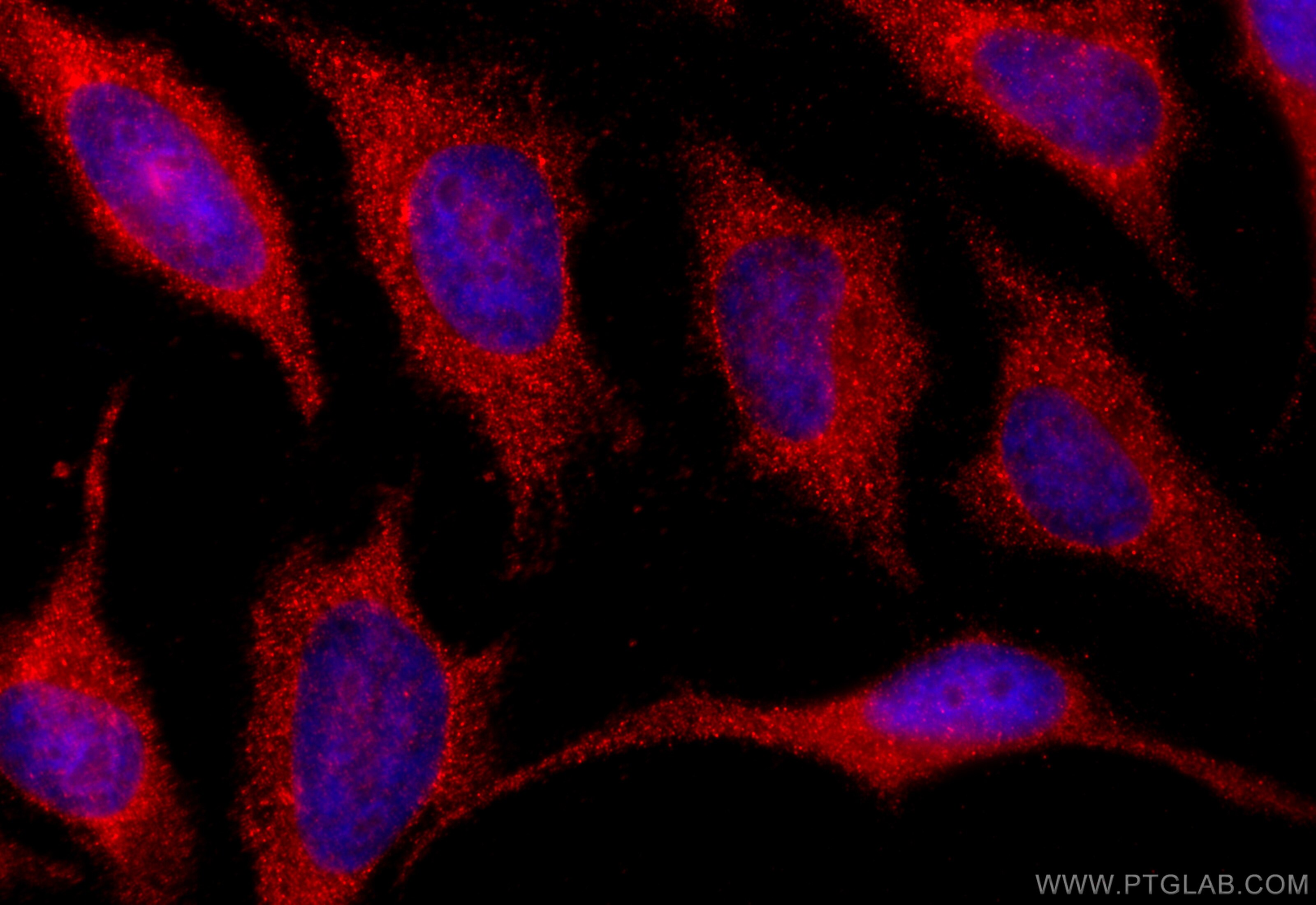 Immunofluorescence (IF) / fluorescent staining of HeLa cells using SLPI Polyclonal antibody (32205-1-AP)