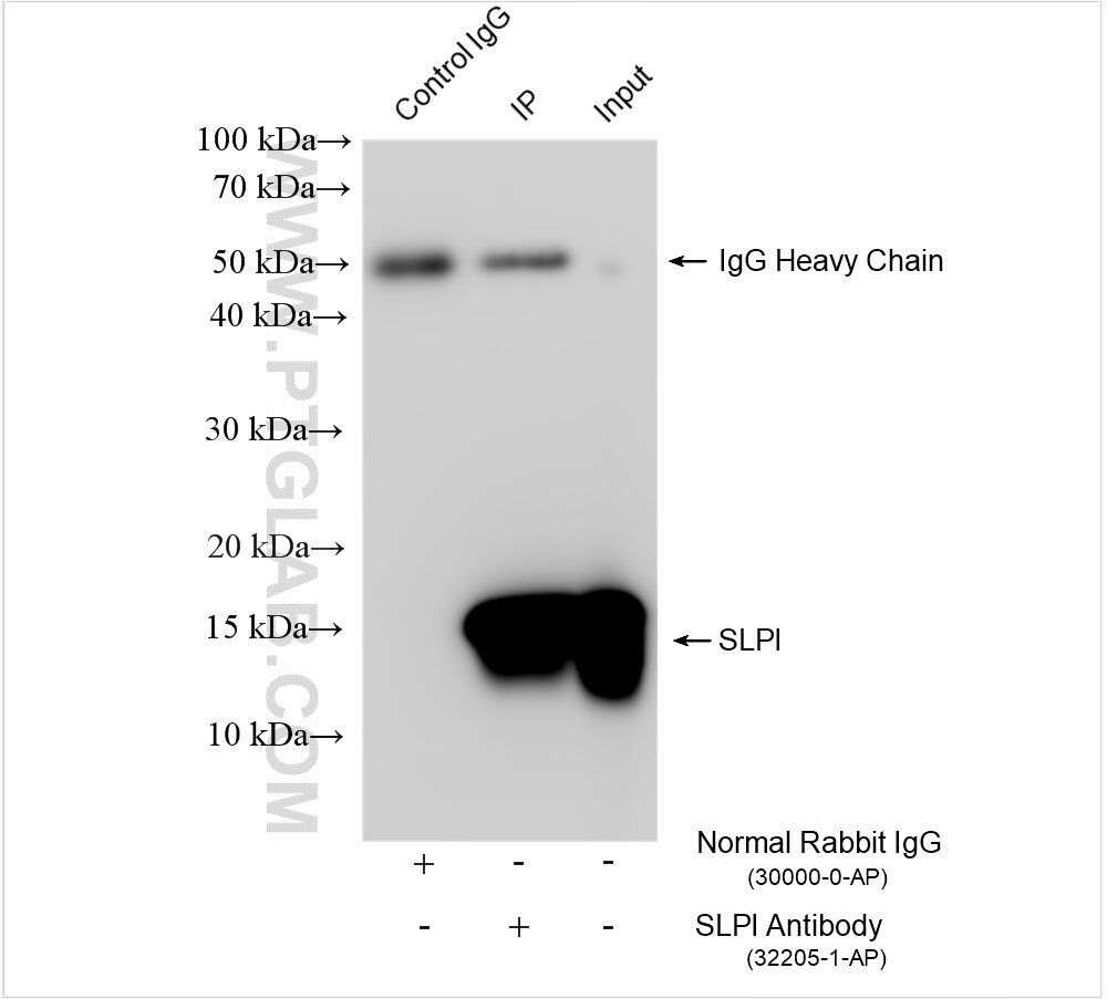 Immunoprecipitation (IP) experiment of human saliva using SLPI Polyclonal antibody (32205-1-AP)
