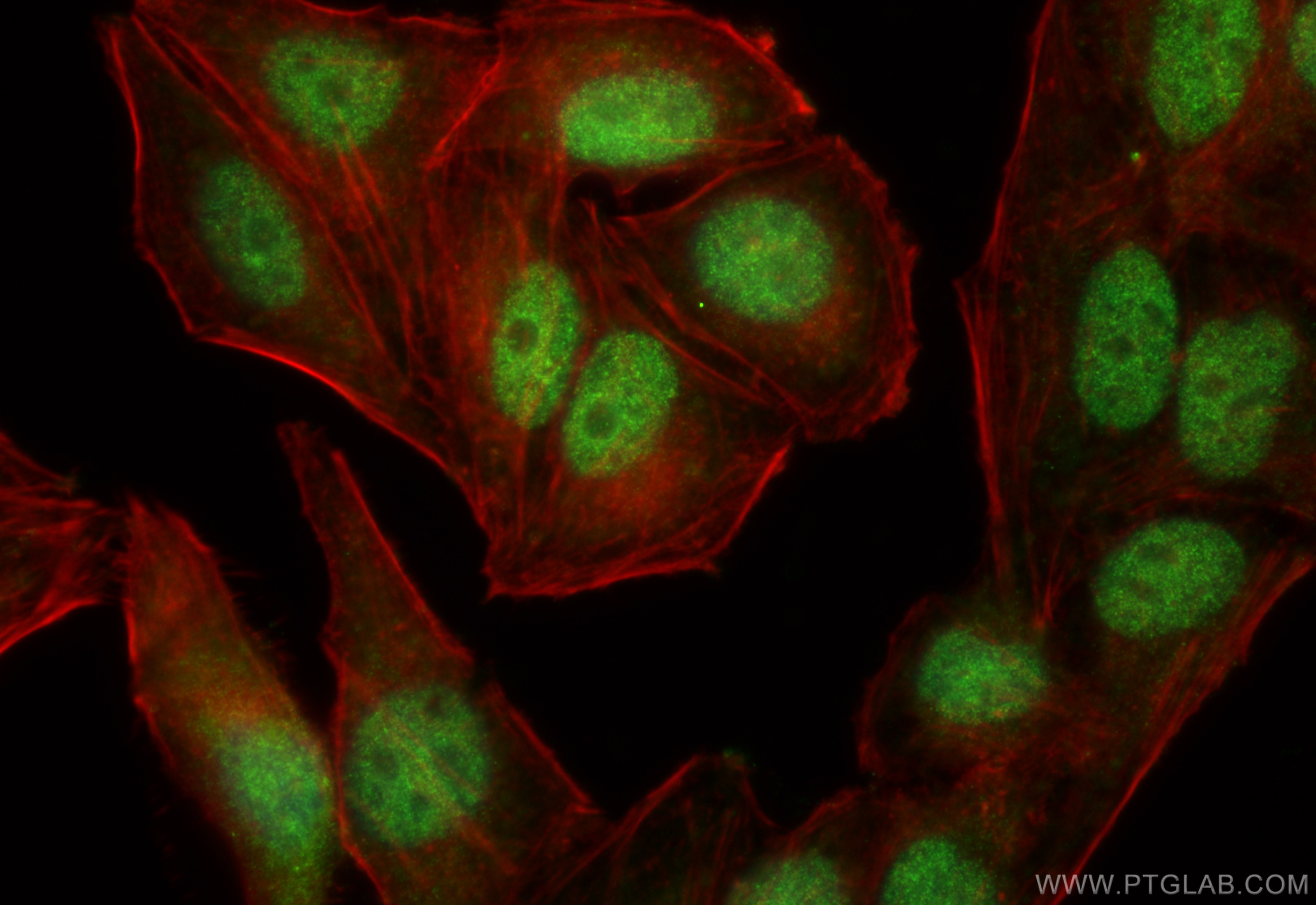 Immunofluorescence (IF) / fluorescent staining of HepG2 cells using SLTM Polyclonal antibody (17889-1-AP)