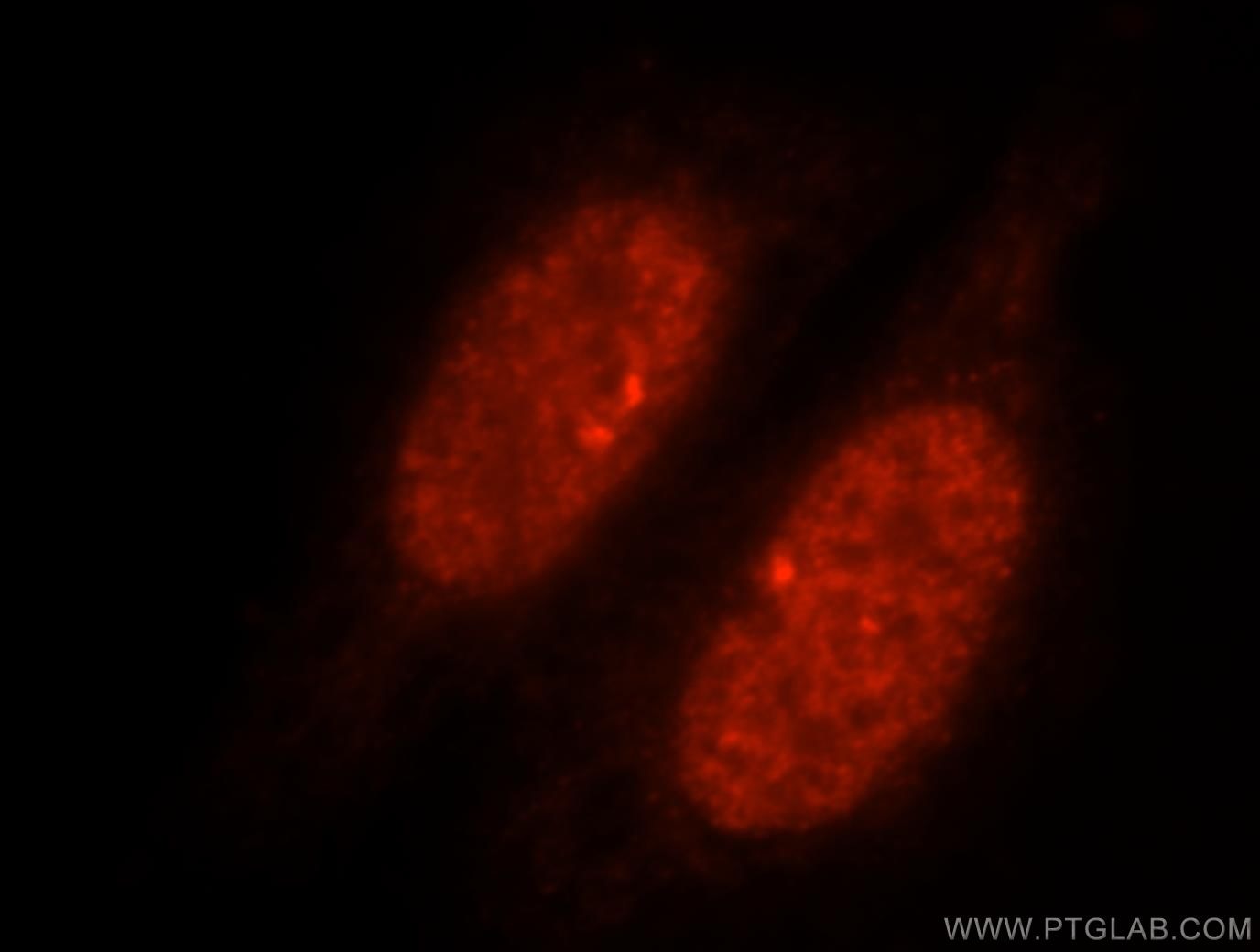 Immunofluorescence (IF) / fluorescent staining of HepG2 cells using SLTM Polyclonal antibody (17889-1-AP)