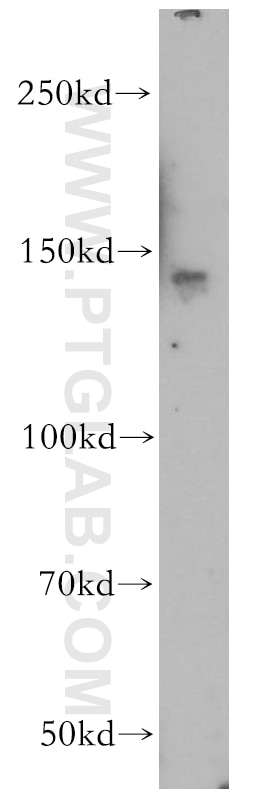 Western Blot (WB) analysis of mouse brain tissue using SLTM Polyclonal antibody (17889-1-AP)