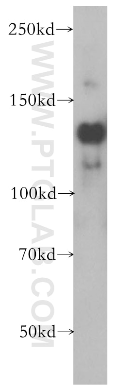 Western Blot (WB) analysis of HeLa cells using SLTM Polyclonal antibody (17889-1-AP)