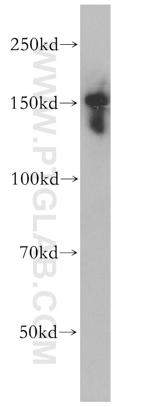 Western Blot (WB) analysis of HeLa cells using SLTM Polyclonal antibody (17889-1-AP)