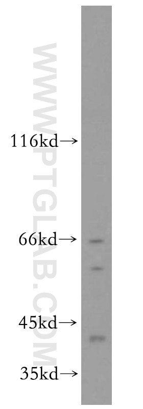 Western Blot (WB) analysis of HeLa cells using SLU7 Polyclonal antibody (12050-1-AP)