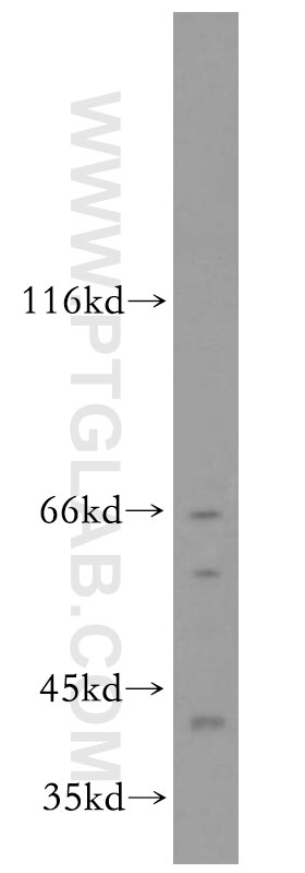 WB analysis of HeLa using 12050-1-AP