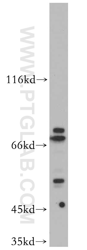 Western Blot (WB) analysis of mouse colon tissue using SLU7 Polyclonal antibody (12050-1-AP)