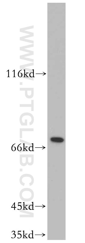 Western Blot (WB) analysis of Jurkat cells using SLU7 Polyclonal antibody (12050-1-AP)