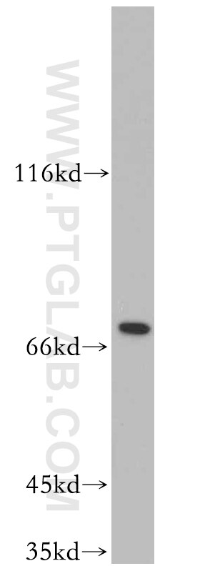 Western Blot (WB) analysis of Jurkat cells using SLU7 Polyclonal antibody (12050-1-AP)