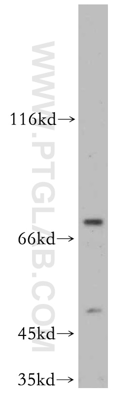 Western Blot (WB) analysis of Y79 cells using SLU7 Polyclonal antibody (12050-1-AP)