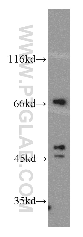 WB analysis of HeLa using 12050-1-AP