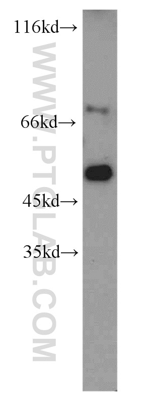 Western Blot (WB) analysis of mouse colon tissue using SLU7 Polyclonal antibody (12050-1-AP)