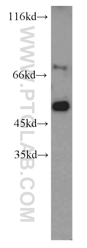 Western Blot (WB) analysis of mouse colon tissue using SLU7 Polyclonal antibody (12050-1-AP)