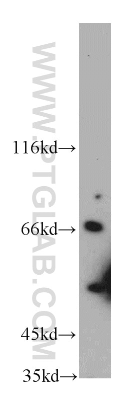 Western Blot (WB) analysis of K-562 cells using SLU7 Polyclonal antibody (12050-1-AP)