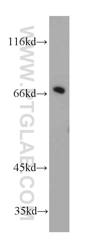 Western Blot (WB) analysis of Jurkat cells using SLU7 Polyclonal antibody (12050-1-AP)