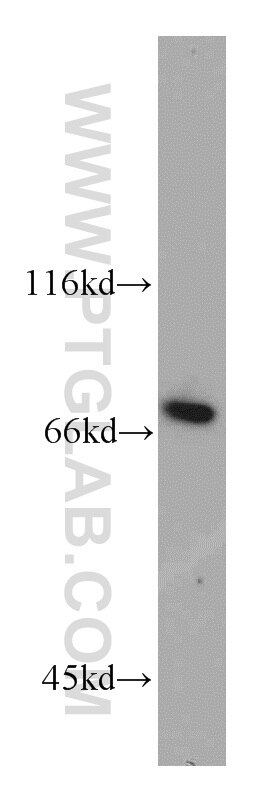 Western Blot (WB) analysis of Y79 cells using SLU7 Polyclonal antibody (12050-1-AP)