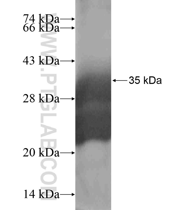 SLURP1 fusion protein Ag18457 SDS-PAGE