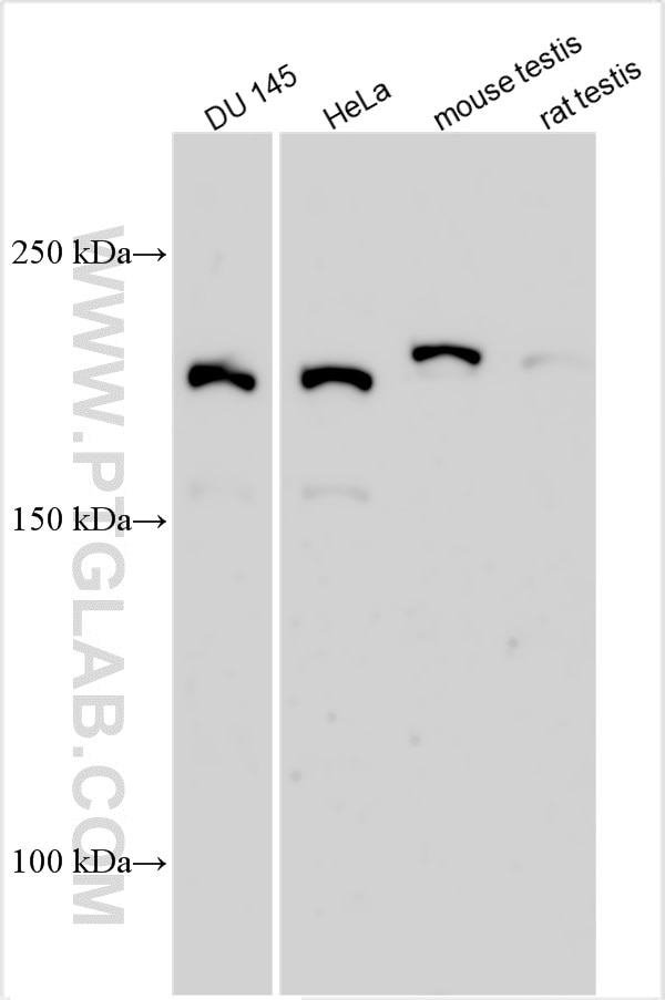 WB analysis using 31867-1-AP (same clone as 31867-1-PBS) Western Blot (WB) analysis of various lysates using SLX4 Polyclonal antibody (31867-1-AP)