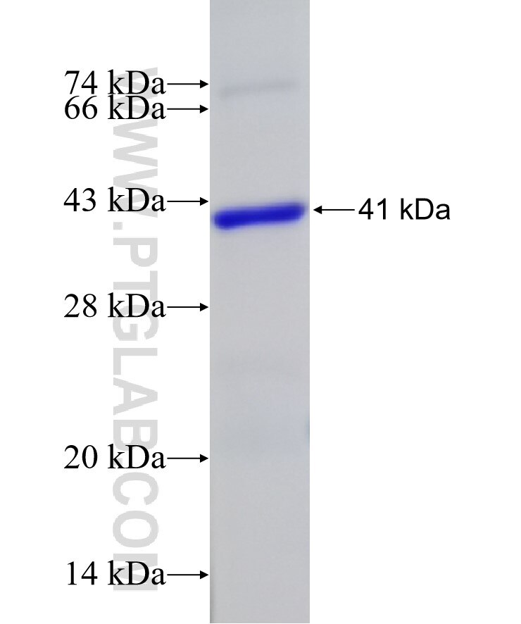 SLX4 fusion protein Ag32941 SDS-PAGE SLX4 fusion protein Ag32941 SDS-PAGE