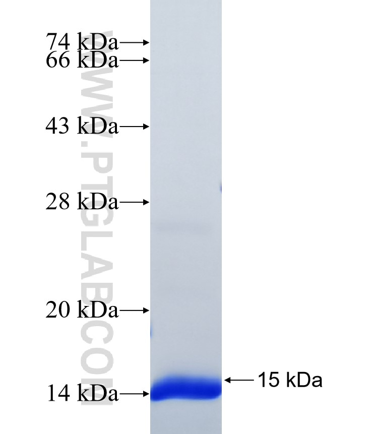 SLX4 fusion protein Ag38677 SDS-PAGE