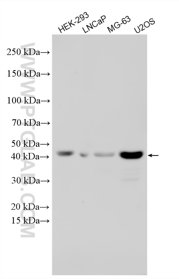 WB analysis using 30497-1-AP (same clone as 30497-1-PBS) Western Blot (WB) analysis of various lysates using SLX4IP Polyclonal antibody (30497-1-AP)