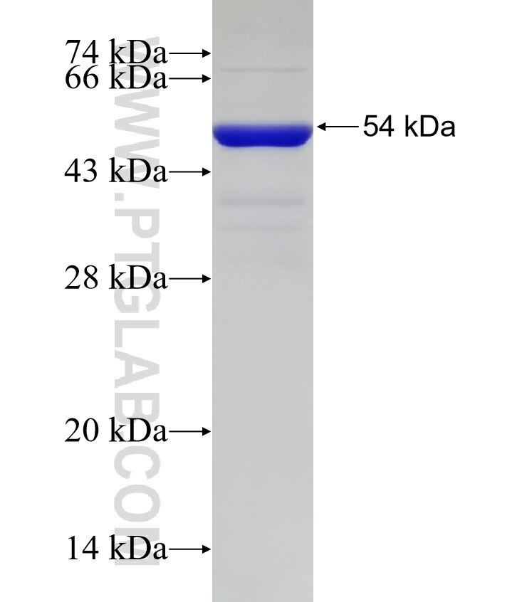 SLX4IP fusion protein Ag33034 SDS-PAGE SLX4IP fusion protein Ag33034 SDS-PAGE