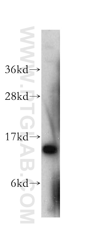 Western Blot (WB) analysis of HeLa cells using SMA4 Polyclonal antibody (10318-1-AP)