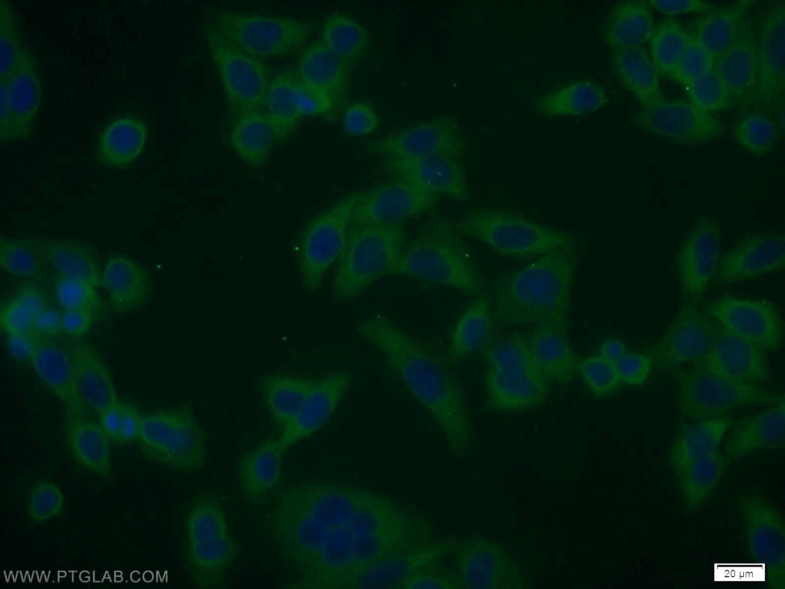 Immunofluorescence (IF) / fluorescent staining of HeLa cells using SMAD1 Polyclonal antibody (10429-1-AP)