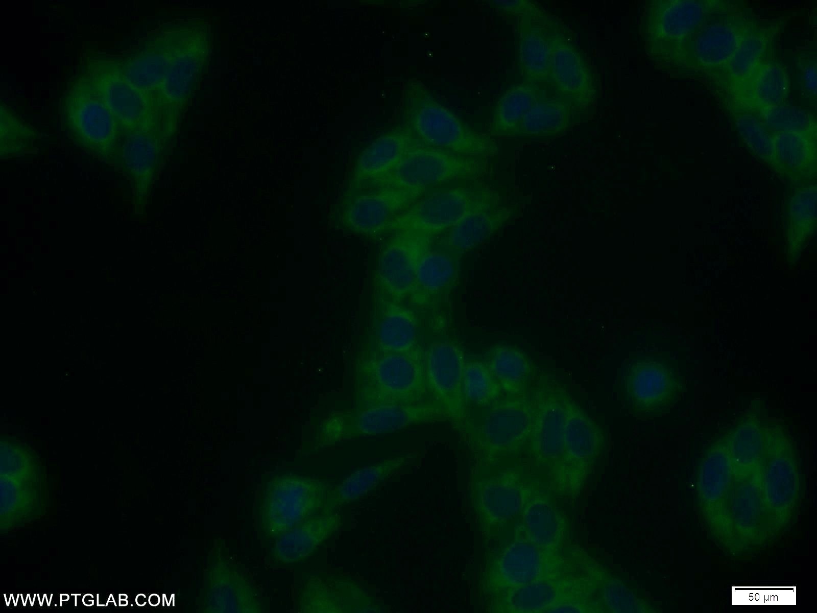 Immunofluorescence (IF) / fluorescent staining of HepG2 cells using SMAD1 Polyclonal antibody (10429-1-AP)