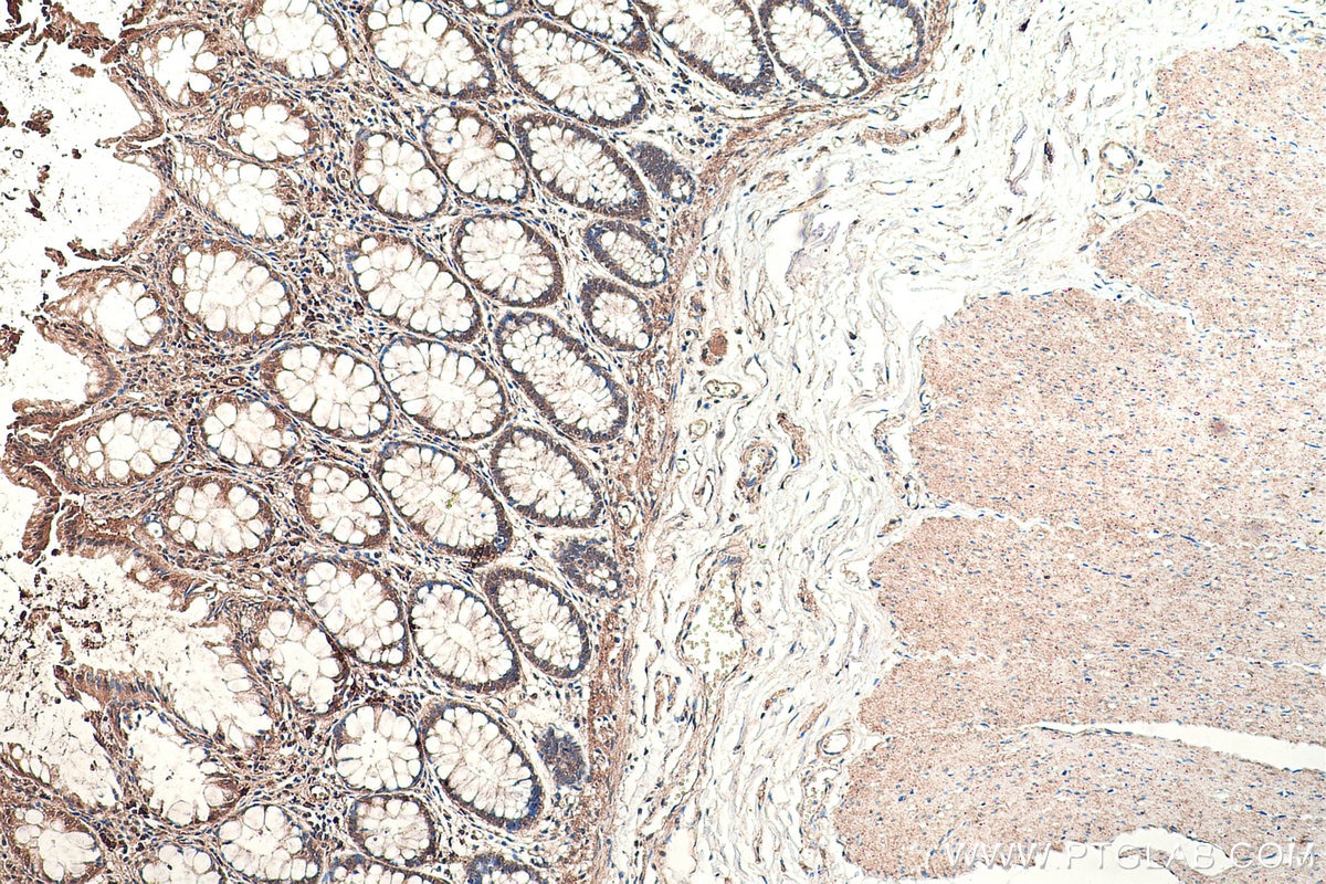 Immunohistochemistry (IHC) staining of human colon tissue using SMAD1 Polyclonal antibody (10429-1-AP)