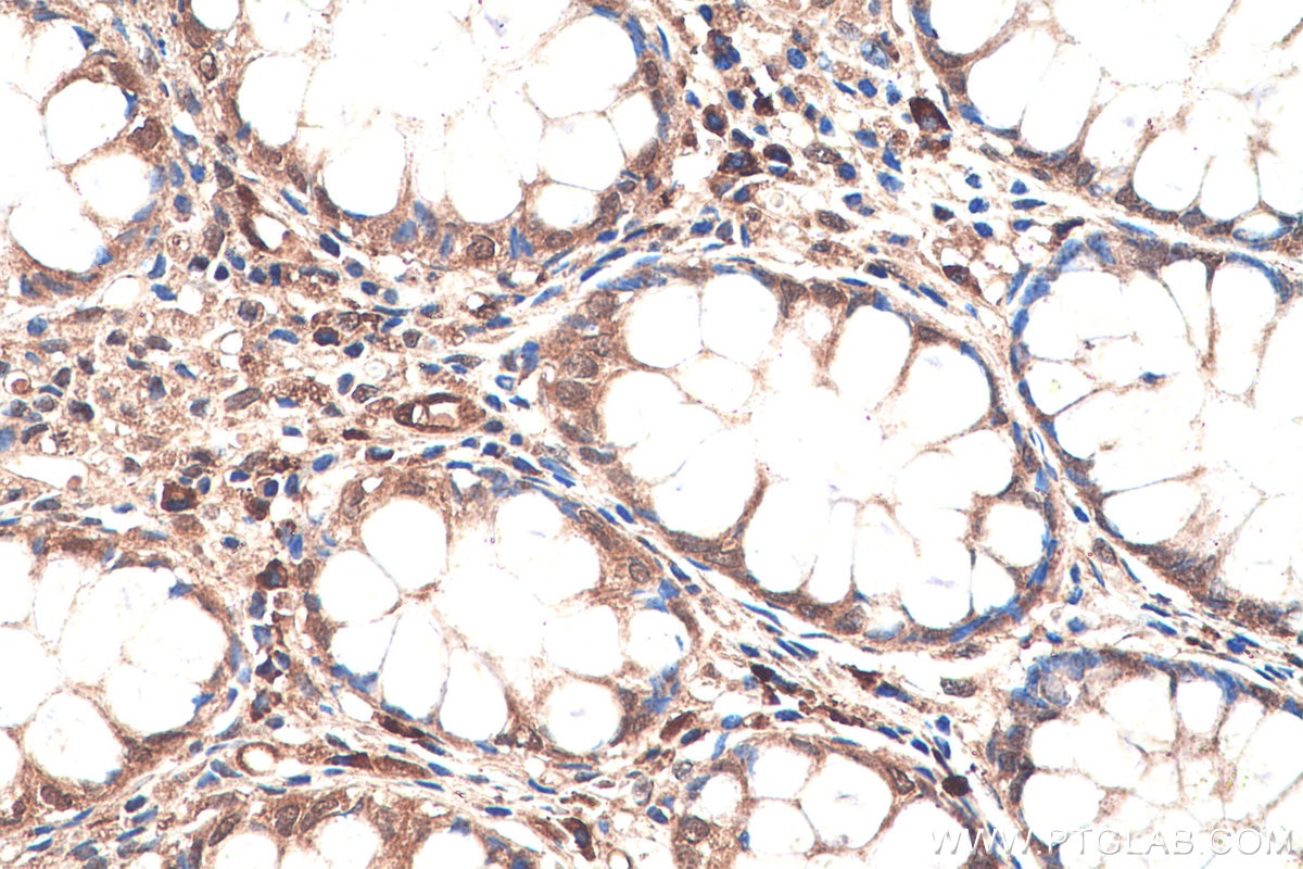 Immunohistochemistry (IHC) staining of human colon tissue using SMAD1 Polyclonal antibody (10429-1-AP)