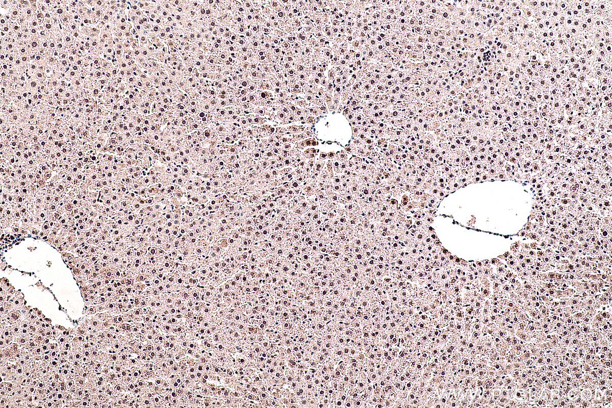 Immunohistochemistry (IHC) staining of rat liver tissue using SMAD1 Polyclonal antibody (10429-1-AP)