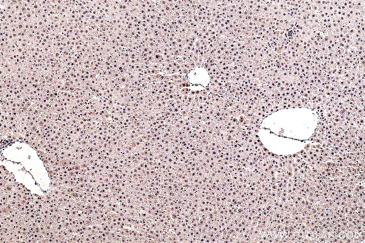 IHC staining of rat liver using 10429-1-AP