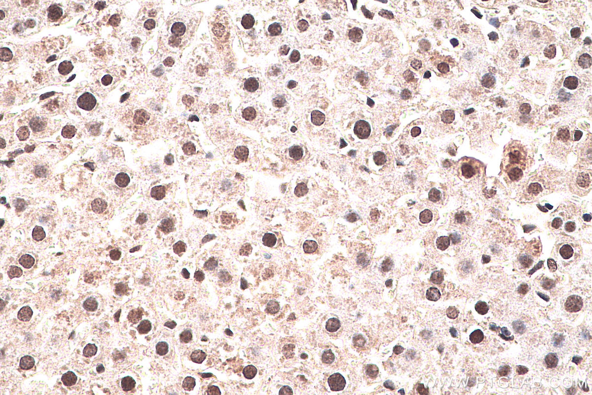 Immunohistochemistry (IHC) staining of rat liver tissue using SMAD1 Polyclonal antibody (10429-1-AP)