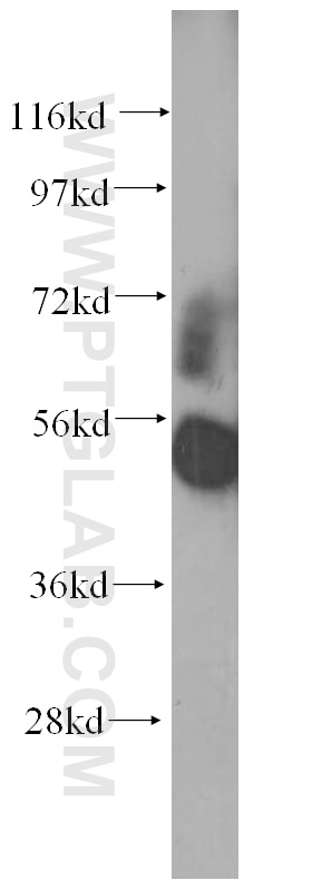 Western Blot (WB) analysis of mouse heart tissue using SMAD1 Polyclonal antibody (10429-1-AP)