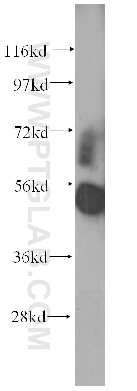 WB analysis of mouse heart using 10429-1-AP