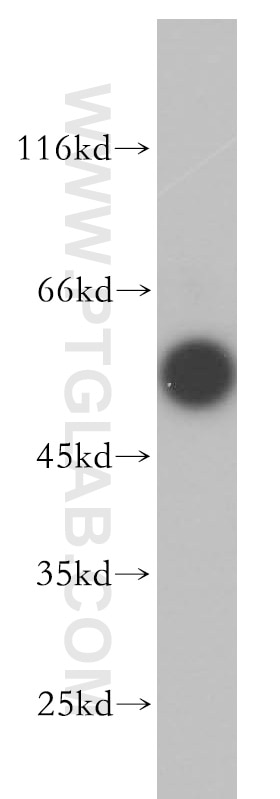 Western Blot (WB) analysis of HepG2 cells using SMAD1 Polyclonal antibody (10429-1-AP)