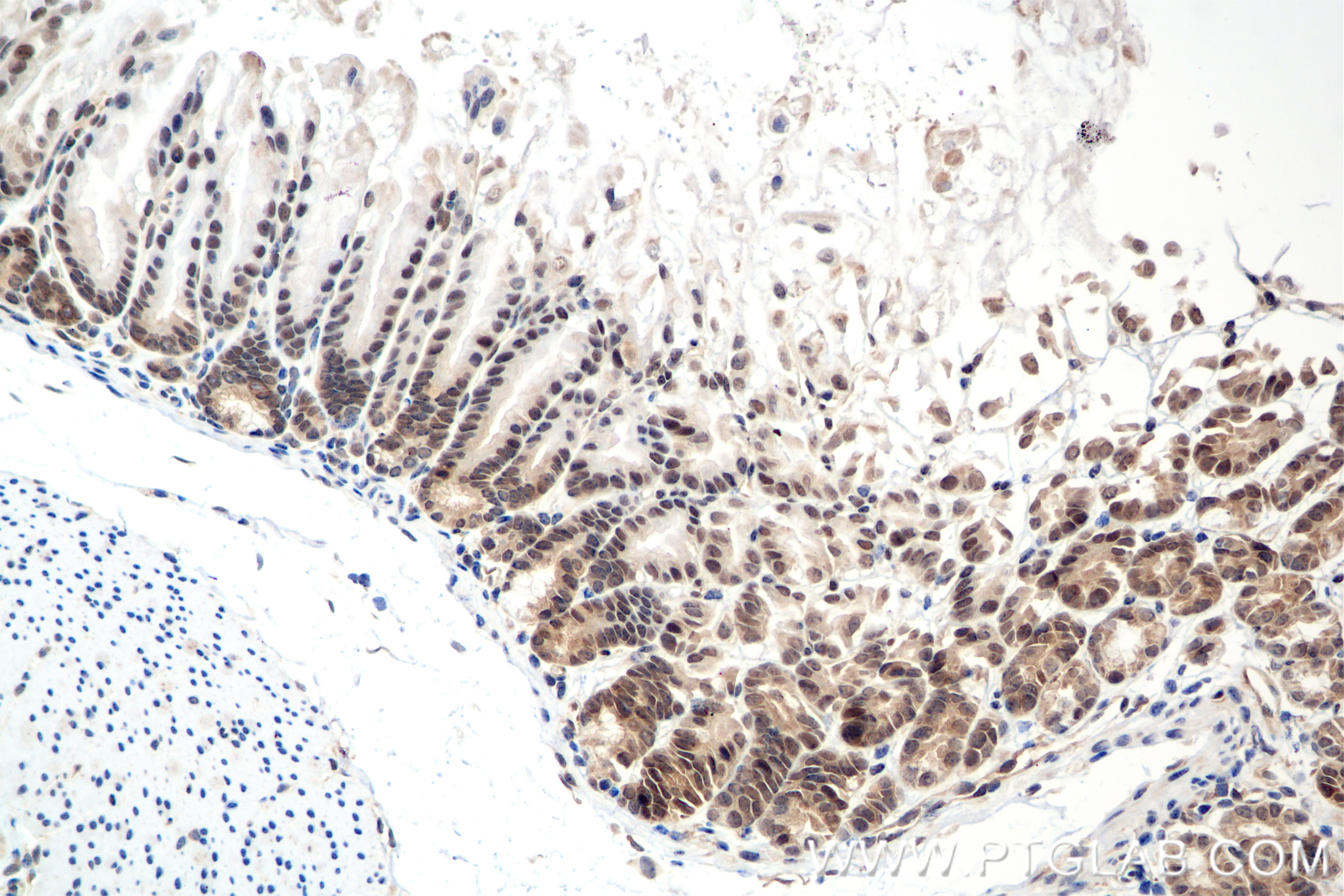 Immunohistochemical analysis of paraffin-embedded mouse stomach tissue slide using 85388-1-RR (SMAD1 antibody) at dilution of 1:500 (under 20x lens). Heat mediated antigen retrieval with Tris-EDTA buffer (pH 9.0). Immunohistochemistry (IHC) staining of mouse stomach tissue using SMAD1 Recombinant monoclonal antibody (85388-1-RR)