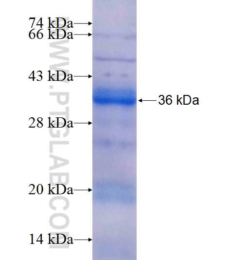 SMAD1 fusion protein Ag22819 SDS-PAGE