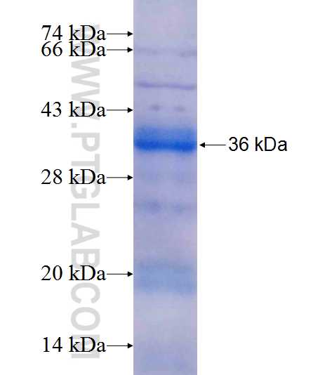SMAD1 fusion protein Ag22819 SDS-PAGE