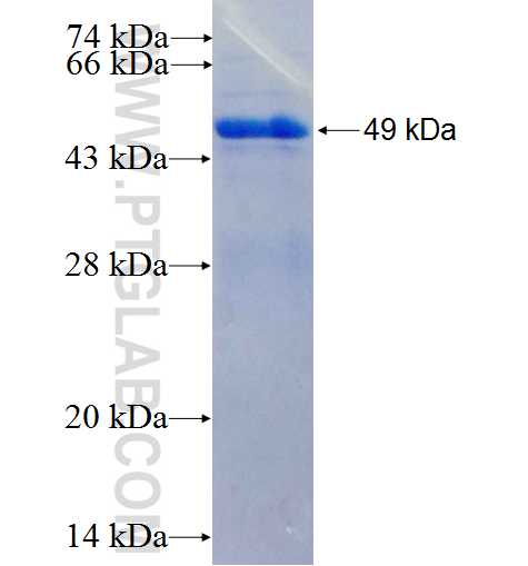 SMAD1 fusion protein Ag0701 SDS-PAGE