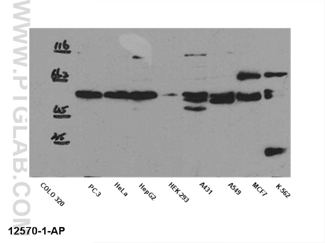 WB analysis of multi-cells using 12570-1-AP