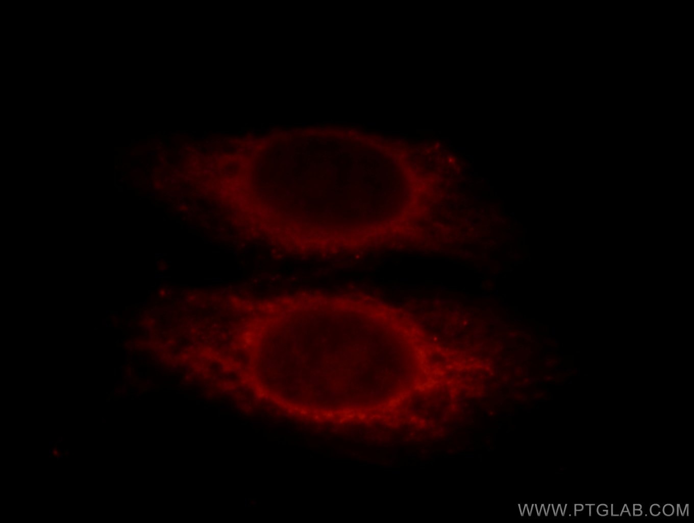 Immunofluorescence (IF) / fluorescent staining of HepG2 cells using SMAD2 Polyclonal antibody (12570-1-AP)