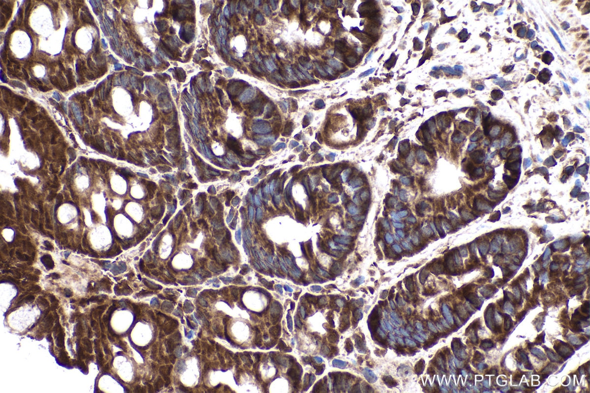 Immunohistochemistry (IHC) staining of mouse colon tissue using SMAD2 Polyclonal antibody (12570-1-AP)
