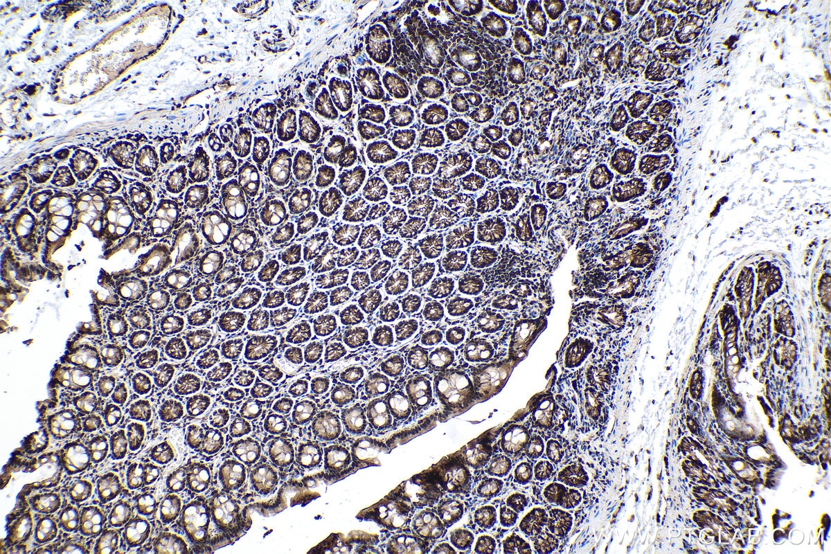 Immunohistochemistry (IHC) staining of rat colon tissue using SMAD2 Polyclonal antibody (12570-1-AP)