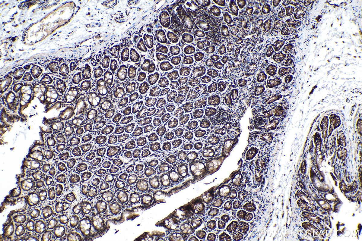 IHC staining of rat colon using 12570-1-AP