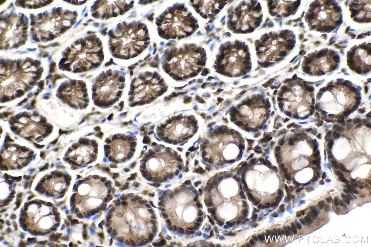 IHC staining of rat colon using 12570-1-AP