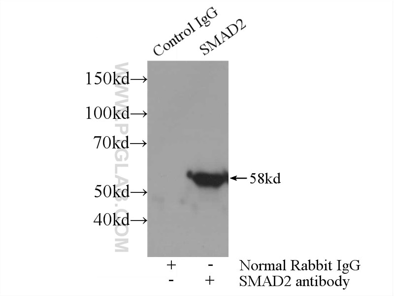 Immunoprecipitation (IP) experiment of HepG2 cells using SMAD2 Polyclonal antibody (12570-1-AP)