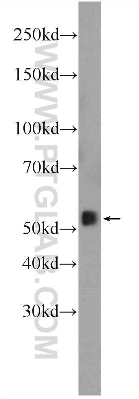 Western Blot (WB) analysis of mouse skeletal muscle tissue using SMAD2 Polyclonal antibody (12570-1-AP)