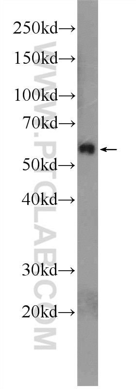 Western Blot (WB) analysis of rat skeletal muscle tissue using SMAD2 Polyclonal antibody (12570-1-AP)