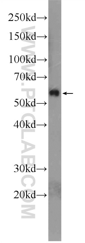 WB analysis of rat skeletal muscle using 12570-1-AP